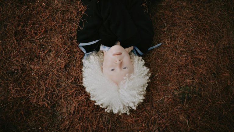 Understanding albinism